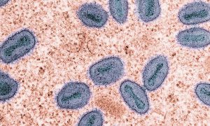 El condado de Wayne confirmó su primer caso de viruela del mono mpox desde 2022.