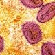 México ya tiene más de 50 casos confirmados de viruela del mono o Mpox.