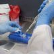Michigan ya acumula más de 10,000 casos de ciclosporiasis en el estado.
